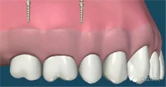 640.webp (9).jpg 640.webp (9).jpg