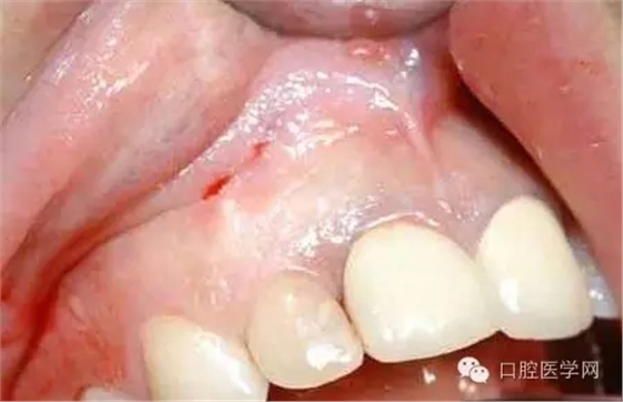 640.webp (1).jpg 640.webp (1).jpg