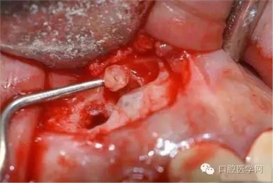 640.webp (6).jpg 640.webp (6).jpg