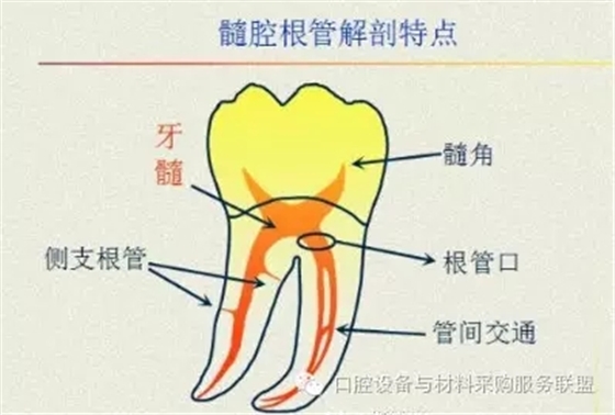 超實用的根管口的探查術(shù) 超實用的根管口的探查術(shù)