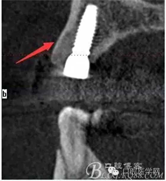 640.webp (14).jpg 640.webp (14).jpg