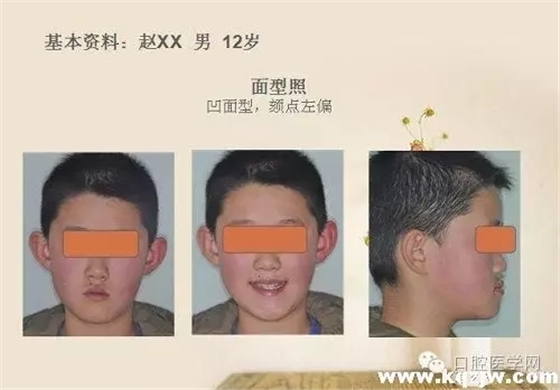 640.webp.jpg 640.webp.jpg