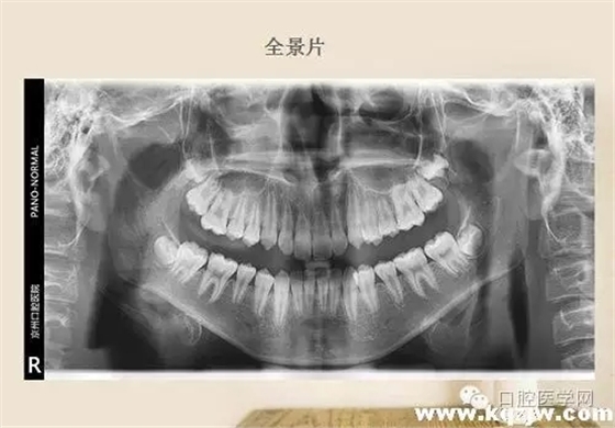 640.webp (2).jpg 640.webp (2).jpg