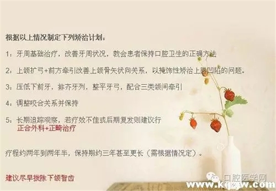 640.webp (4).jpg 640.webp (4).jpg