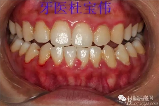 640.webp.jpg 640.webp.jpg