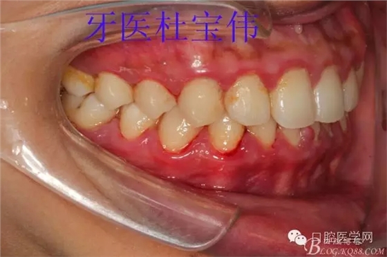 640.webp (1).jpg 640.webp (1).jpg