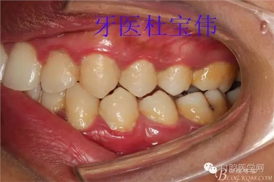 640.webp (2).jpg 640.webp (2).jpg