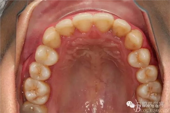 640.webp (3).jpg 640.webp (3).jpg