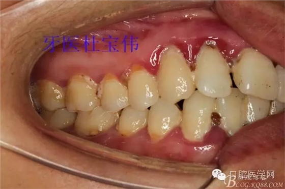 640.webp (11).jpg 640.webp (11).jpg