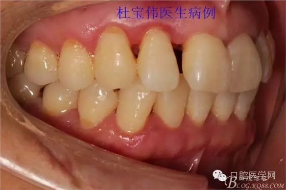 640.webp (16).jpg 640.webp (16).jpg