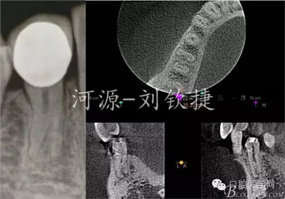 640.webp.jpg 640.webp.jpg