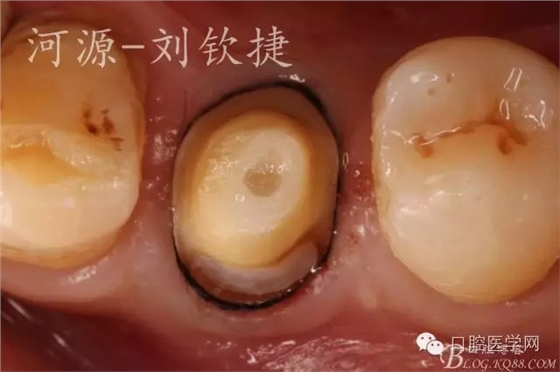 640.webp (4).jpg 640.webp (4).jpg