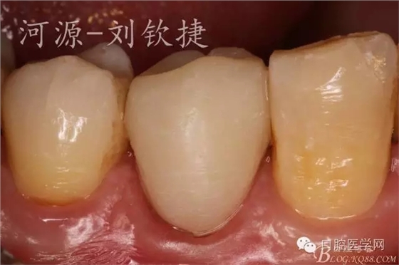 640.webp (11).jpg 640.webp (11).jpg