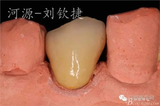 640.webp (17).jpg 640.webp (17).jpg