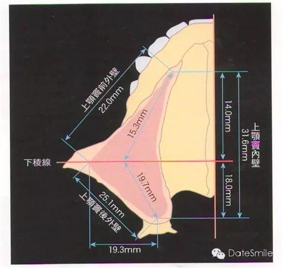 0.webp (2).jpg 0.webp (2).jpg