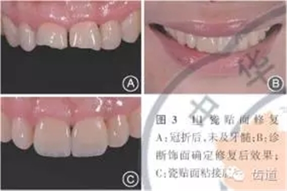 640.webp (2).jpg 640.webp (2).jpg