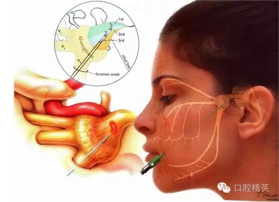 640.webp.jpg 640.webp.jpg