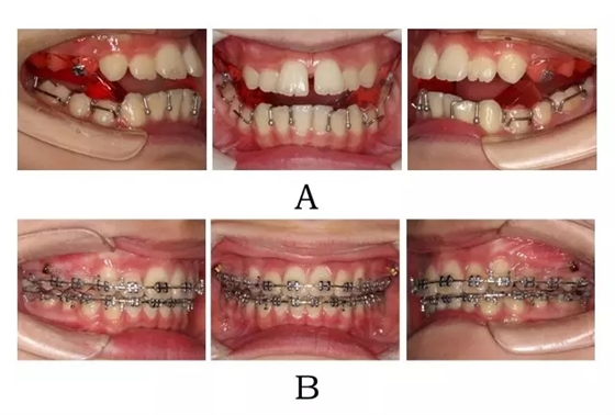 640.webp (2).jpg 640.webp (2).jpg