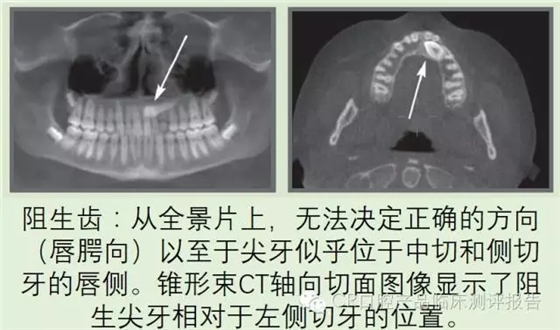 640.webp (3).jpg 640.webp (3).jpg