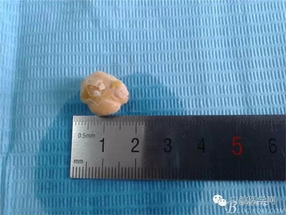 640.webp.jpg 640.webp.jpg