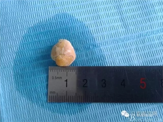 640.webp (2).jpg 640.webp (2).jpg