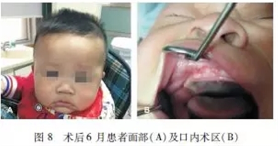 640.webp (12).jpg 640.webp (12).jpg