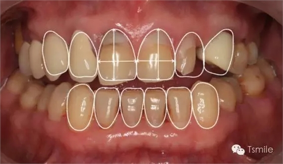 640.webp.jpg 640.webp.jpg