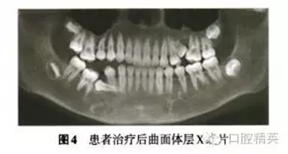 640.webp (18).jpg 640.webp (18).jpg