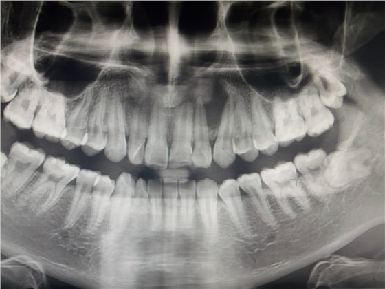 webwxgetmsgimg.jpg webwxgetmsgimg.jpg