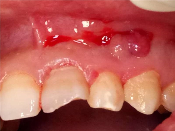 webwxgetmsgimg (1).jpg webwxgetmsgimg (1).jpg