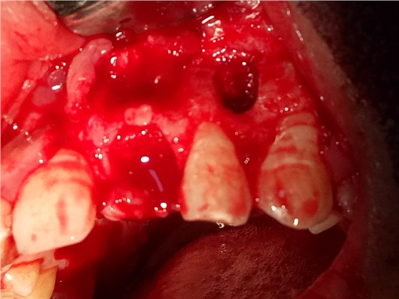 webwxgetmsgimg (7).jpg webwxgetmsgimg (7).jpg