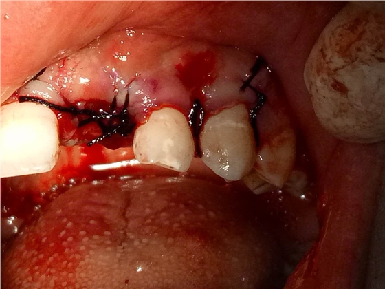 webwxgetmsgimg (8).jpg webwxgetmsgimg (8).jpg