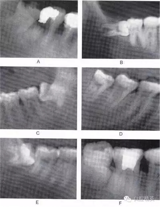 640.webp (7).jpg 640.webp (7).jpg