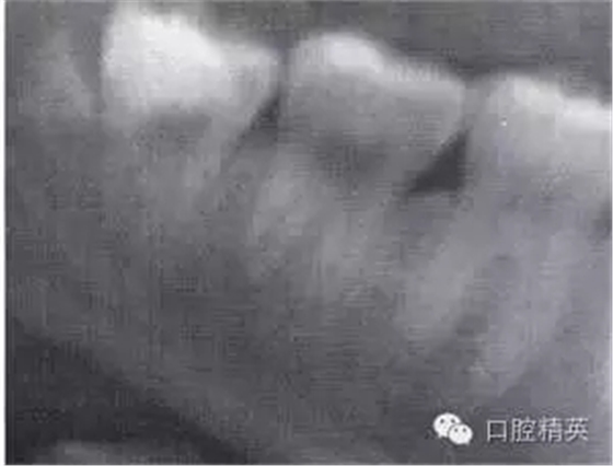 640.webp (9).jpg 640.webp (9).jpg