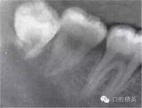 640.webp (10).jpg 640.webp (10).jpg