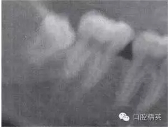 640.webp (11).jpg 640.webp (11).jpg