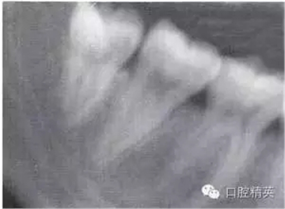 640.webp (13).jpg 640.webp (13).jpg