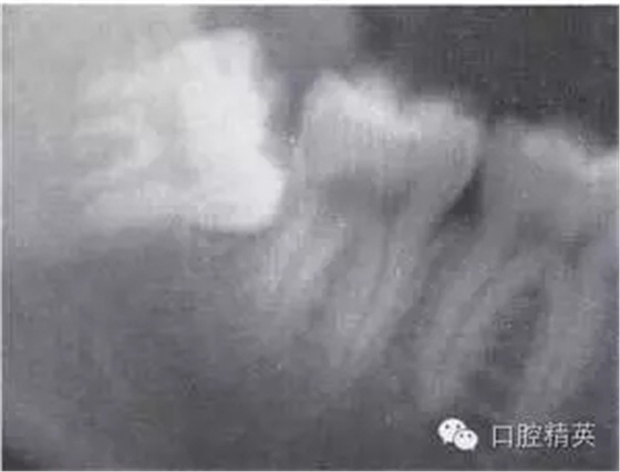 640.webp (14).jpg 640.webp (14).jpg