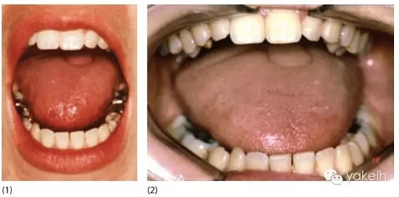 640.webp (1).jpg 640.webp (1).jpg