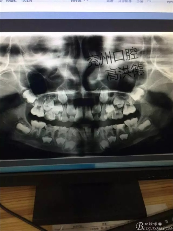 640.webp (1).jpg 640.webp (1).jpg