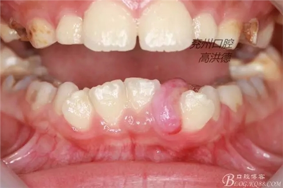 640.webp (2).jpg 640.webp (2).jpg