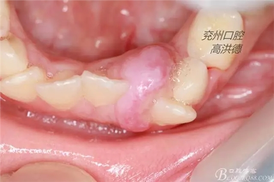 640.webp (3).jpg 640.webp (3).jpg