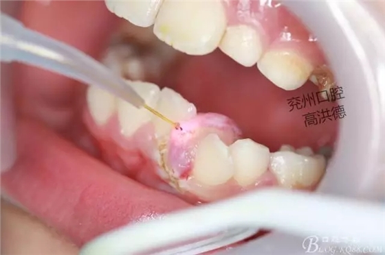 640.webp (9).jpg 640.webp (9).jpg