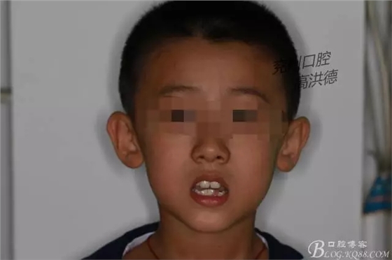 640.webp.jpg 640.webp.jpg