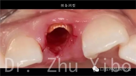 640.webp (4).jpg 640.webp (4).jpg