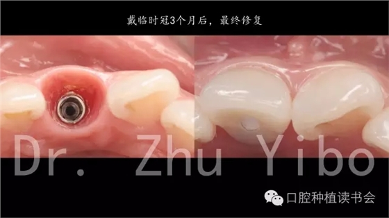 640.webp (9).jpg 640.webp (9).jpg