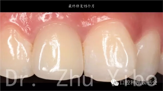 640.webp (13).jpg 640.webp (13).jpg