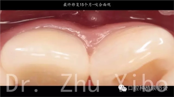 640.webp (14).jpg 640.webp (14).jpg