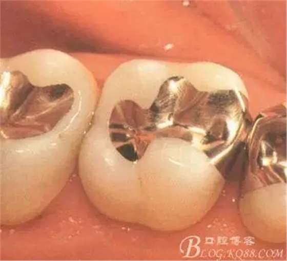 640.webp.jpg 640.webp.jpg