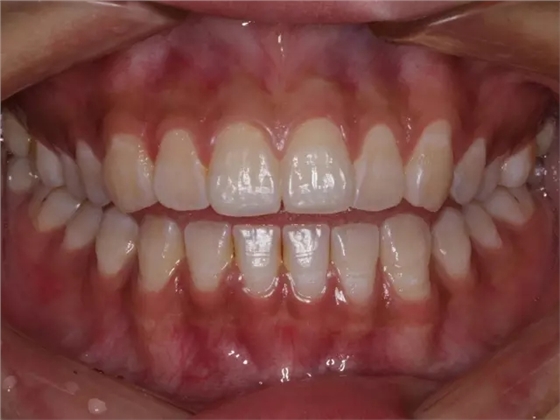 640.webp.jpg 640.webp.jpg